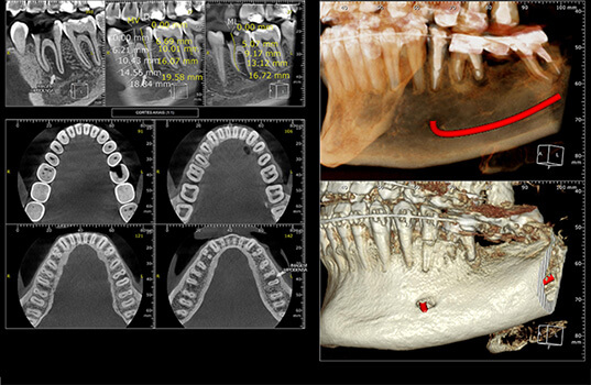 Dor na articulação da mandíbula: o que fazer? - Odonto Scan